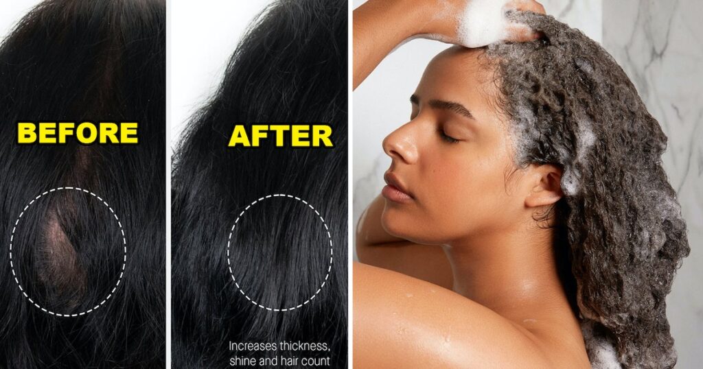 How Augustinus Bader’s Hair Care Goods Can Assist Beat Hair Decline